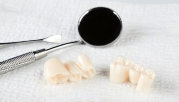 What to Expect After Getting a Same-Day Dental Crown