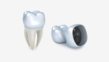 How Same-Day Crowns Can Save Time and Restore Your Smile